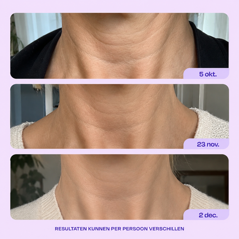 Tighten & Lift Neck Cream