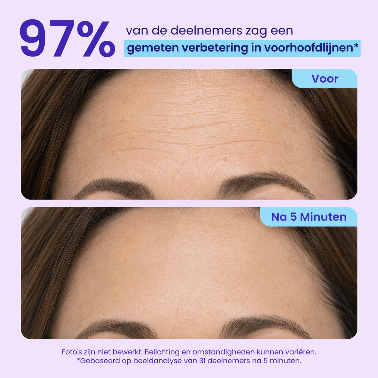 Instant Lift Eye Gel