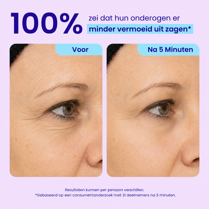 Instant Lift Eye Gel