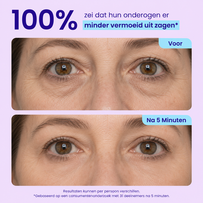 Instant Lift Eye Gel