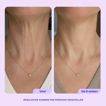 Tighten & Lift Neck Cream