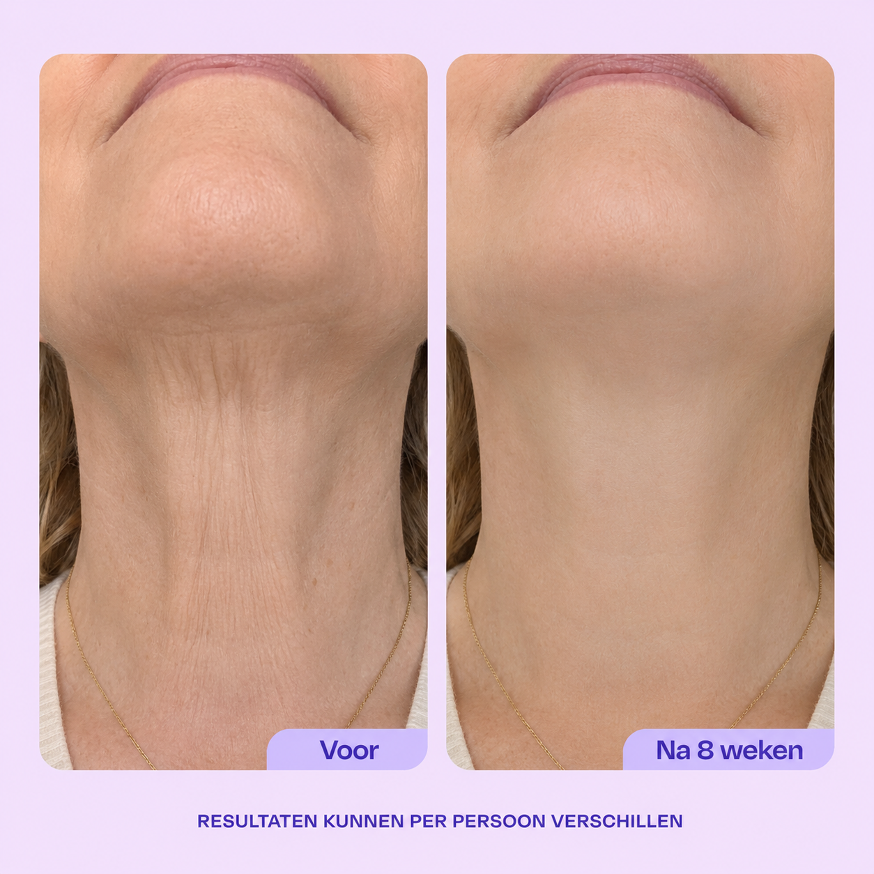 Tighten & Lift Neck Cream